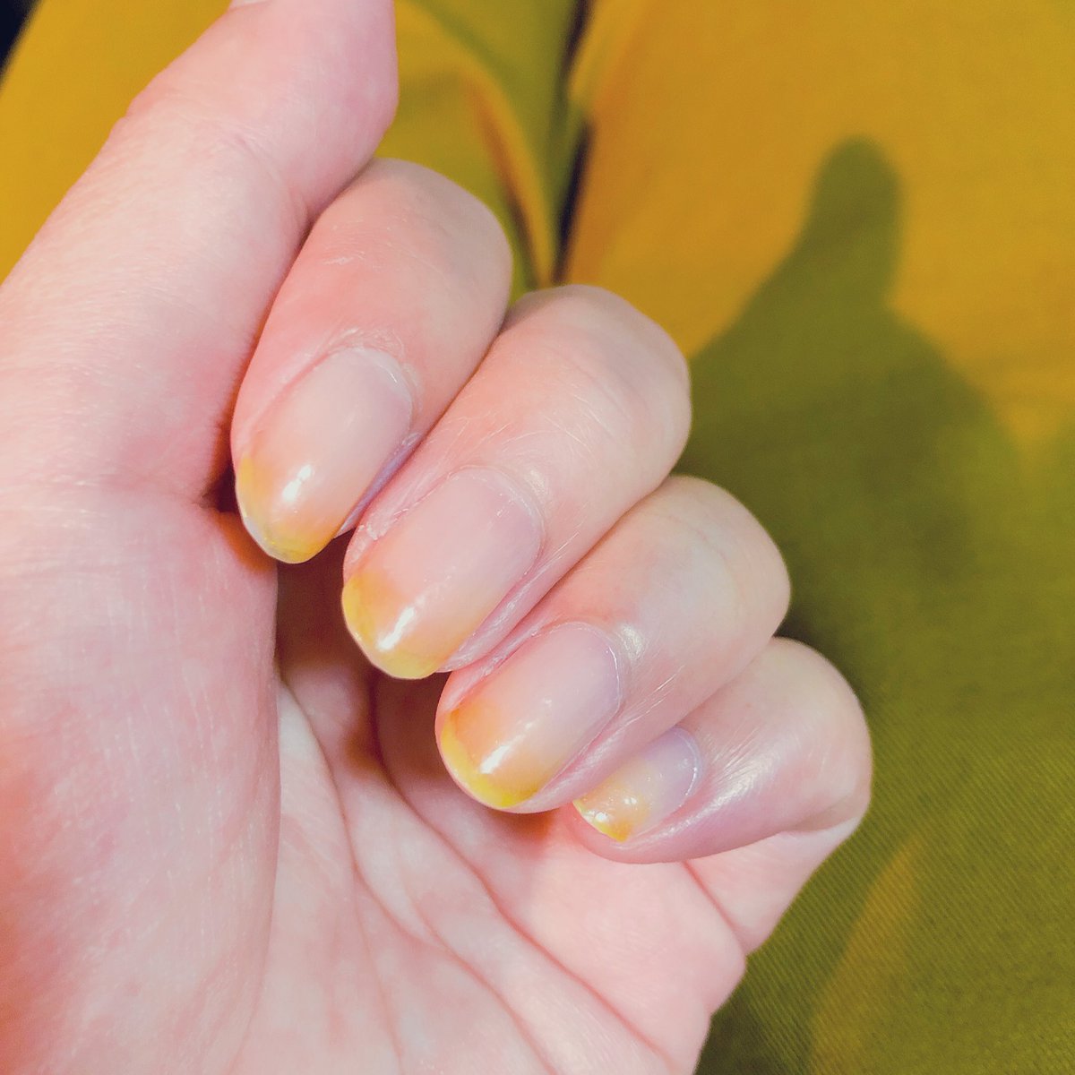 Em 罒 プ垢 この黄色のマニキュア 100均で買ったんやけど色がかわいーのよ みかん食べすぎネイル W