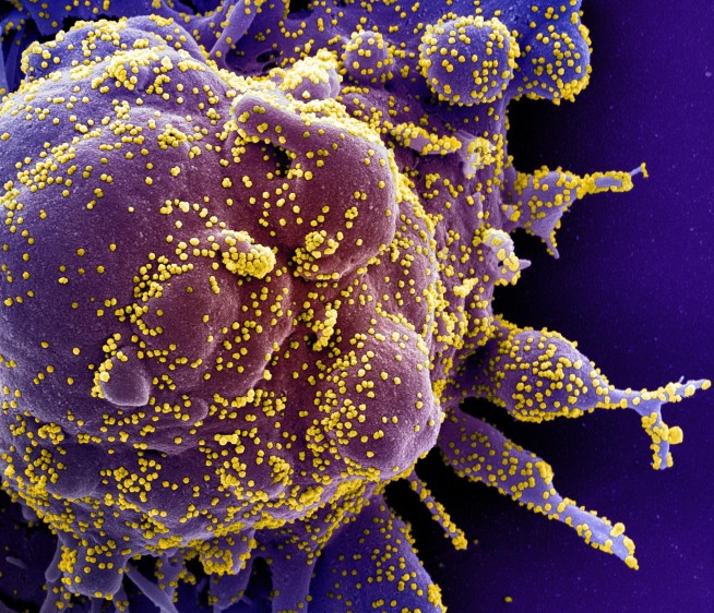elcolombiano's tweet photo. ¿Alguna vez te has preguntado cómo luce el enemigo contra el que el planeta lucha desde hace cuatro meses?
Este es el coronavirus a color, según muestras recogidas de pacientes. Aquí más imágenes 👉 https://t.co/MYbzjjoqmt https://t.co/nHpH3SpJNF