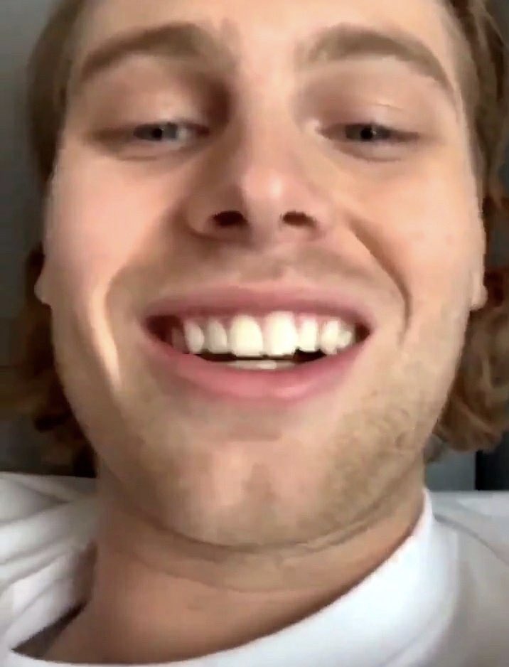 Day 7: Luke Hemmings realising there’s no filter