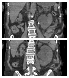 Andrew Portis, MD tweet media