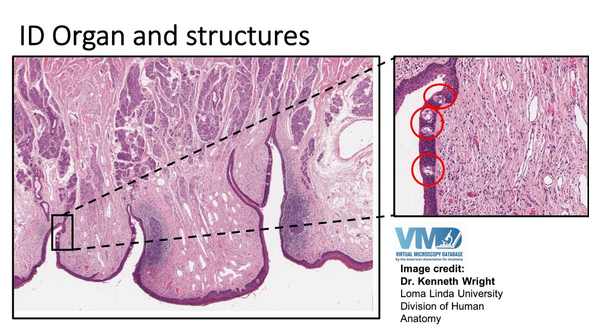 I appreciate these structures’ hard work every meal and snack time (yummm)! ID organ and the highlighted structure in the zoomed box.
#Educators and #researchers Join virtualmicroscopydatabase.org for more virtual slides! #histology #embryology #anatomy
#staysafeandhealthy