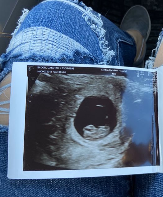 cocochhannel's tweet photo. 8 weeks vs 20 weeks 🥰 https://t.co/zVNNBRzMFx