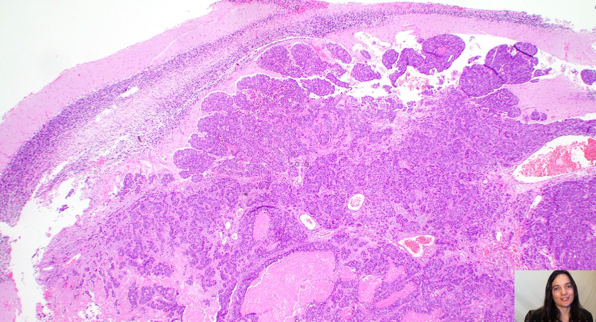Adventures in Neuropathology tweet media