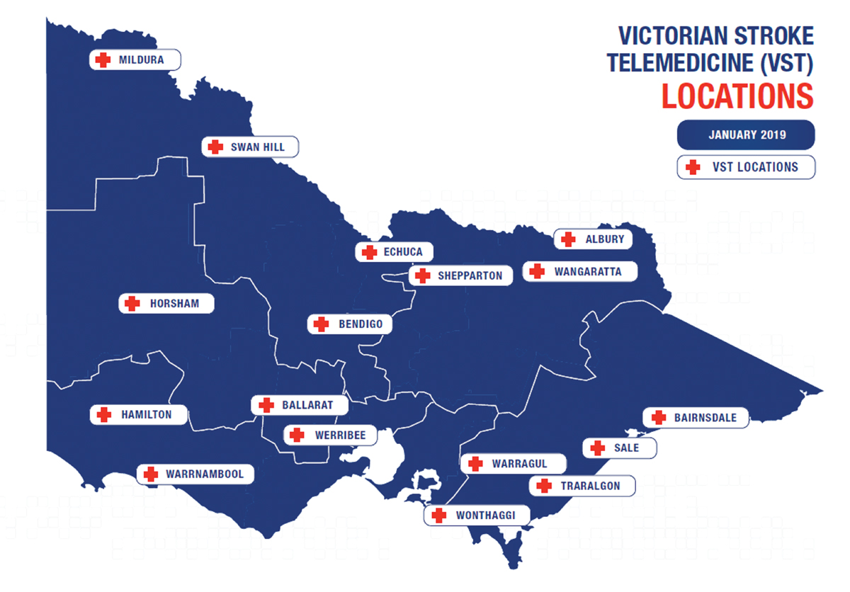 MJA (@themja) on Twitter photo Improving acute #stroke care in regional hospitals: clinical evaluation of the Victorian Stroke Telemedicine program … #openaccess #research … "outcomes equivalent to, if not better than those achieved in metropolitan hospitals in Australia" mja.com.au/journal/2020/2… #MedTwitter Improving acute #stroke care in regional hospitals: clinical evaluation of the Victorian Stroke Telemedicine program … #openaccess #research … "outcomes equivalent to, if not better than those achieved in metropolitan hospitals in Australia" mja.com.au/journal/2020/2… #MedTwitter
