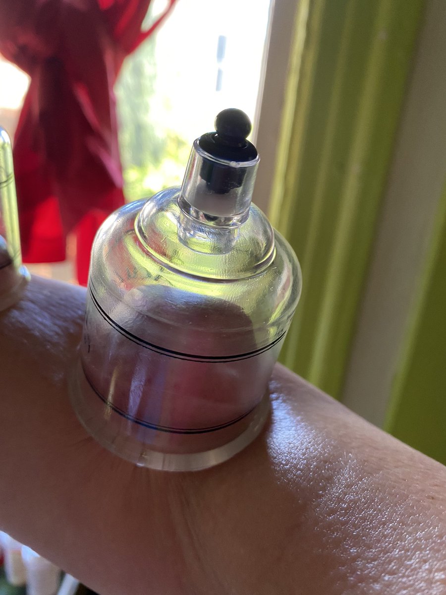 MsZOEKat's tweet photo. Cupping Set came on Amazon. DYI healing at its best and then I ate oatmeal cookies.#cookies #cupping#advice #cellpopping #delicious #glutenfree https://t.co/f8Y3MHsPYZ