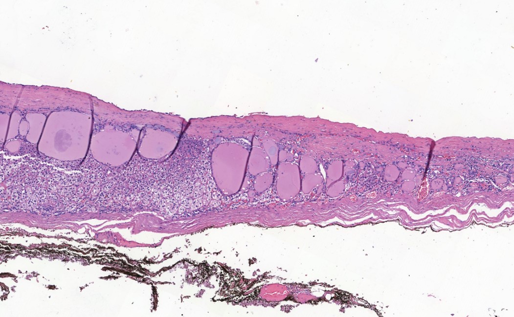 smlungpathguy tweet picture