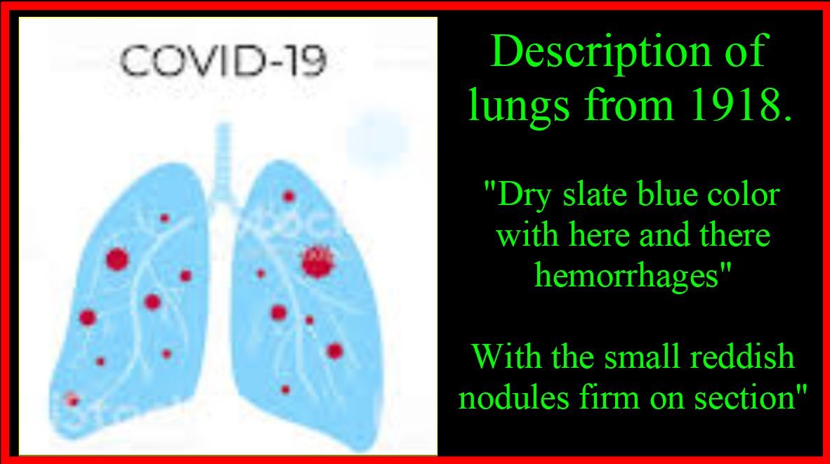 “All been done before in 1918. Link to the medical reports for  #USDeathCamps (Lie being soldiers at army bases)             #StopChinaVirus You are not told they were all black! Fungus destroyed the lungs in most just like COVID-19”  http://history.amedd.army.mil/booksdocs/wwi/ …