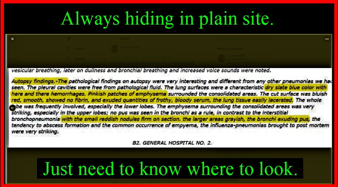 “All been done before in 1918. Link to the medical reports for  #USDeathCamps (Lie being soldiers at army bases)             #StopChinaVirus You are not told they were all black! Fungus destroyed the lungs in most just like COVID-19”  http://history.amedd.army.mil/booksdocs/wwi/ …