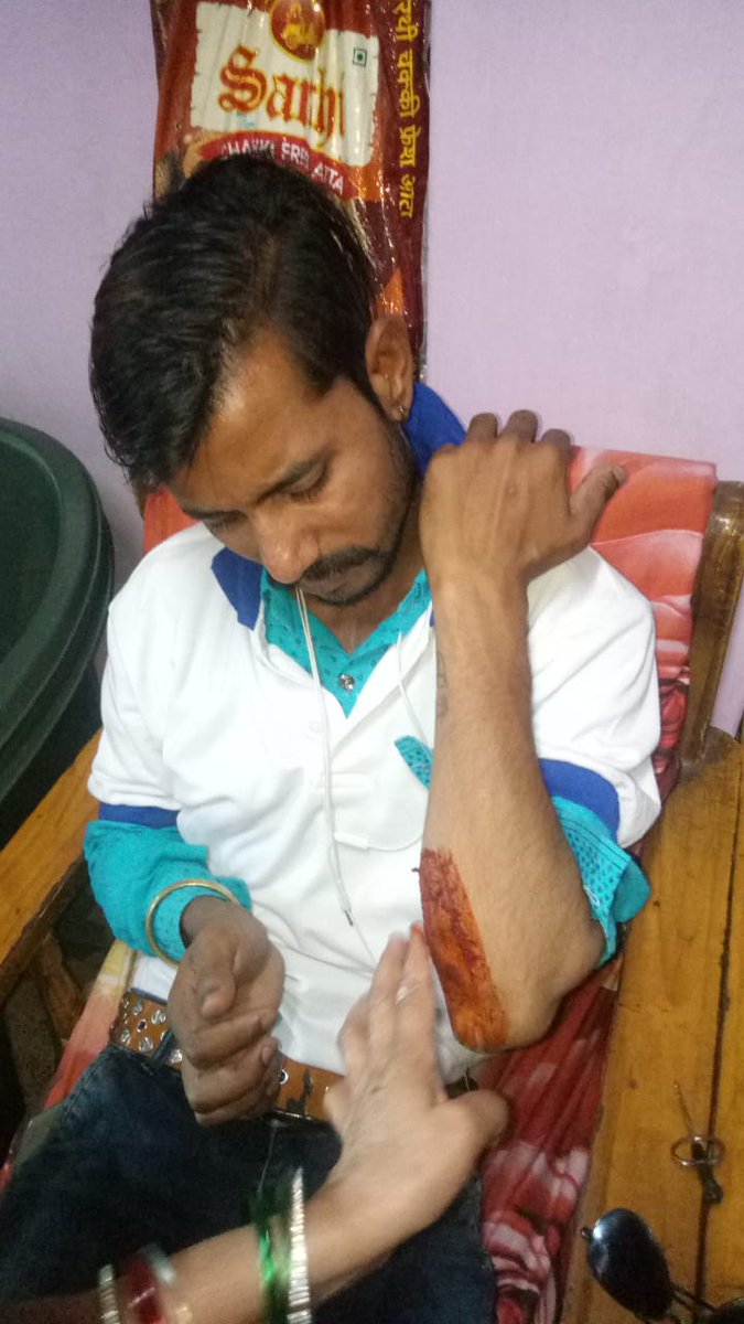 AMBERNAYAK's tweet photo. This is the treatment u gave for serving our Country. Bank employee beaten by #BhopalPolice , ID card torn up. We 2 r vulnerable. Shameful act. No Insurance,no protection only Lathis to #Bankers @ChouhanShivraj @nsitharaman  @DFS_India #BankersOnDuty #BankersHaiPoliceNahin https://t.co/Xejv6fCqek