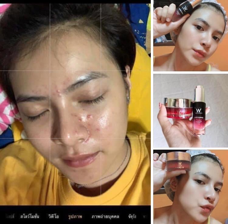 krogkwann's tweet photo. คือหน้าใสแบบไม่ง้อแอพแหละบอกเลย
#whiteessence + #wcream 
#ใช้ดีบอกต่อ
#howtoperfect
#howtoperfect https://t.co/MZzusnU2VH