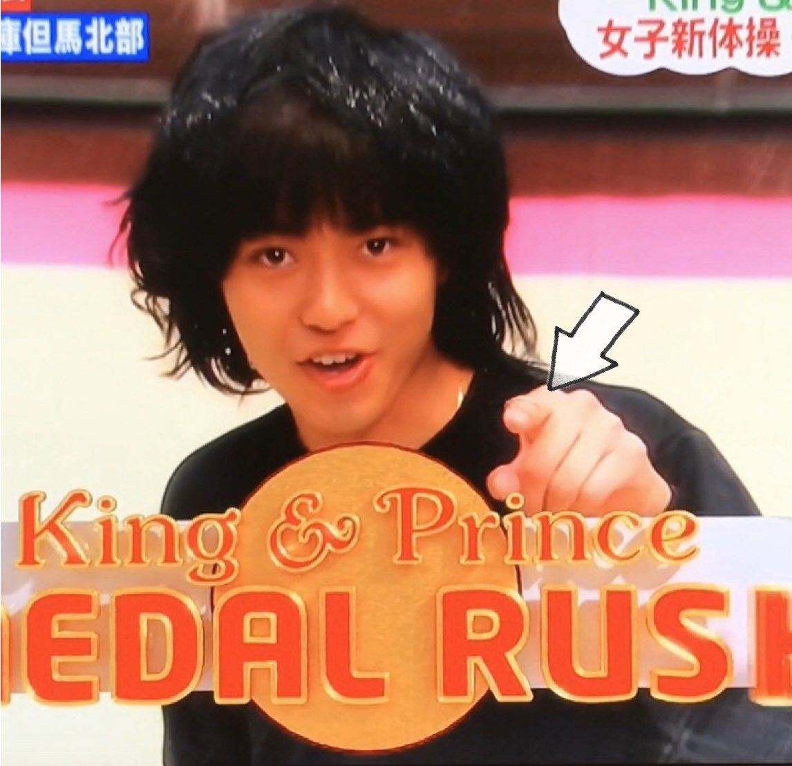 Amy 廉くんに恋してる ええええ 廉くん左手の人差し指怪我してる 絆創膏貼ってある 以前の血の滲んだ 絆創膏のデジャブw まさかカルボナーラ作った時の W ああっ 何だろなぁ この不器用さ 永瀬廉 Medalrash Kingandprince