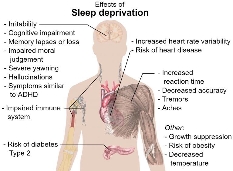 theFATslayerCOM's tweet photo. Coronavirus pandemic has forced billions of people indoors.Most people spend this time on binge-watching tv-series or reading never-ending depressing news late in the night.Every hour spent on watching something at night is the hour stolen from your body's need for a good night's https://t.co/7HsOUcBDz0