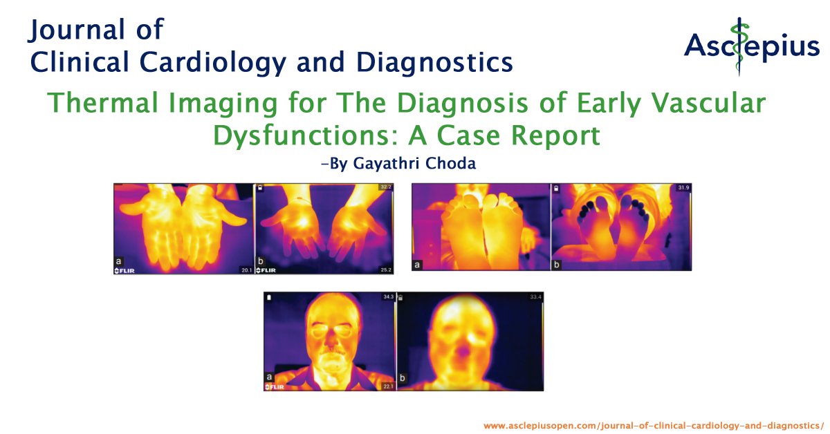 asclepiusopen's tweet photo. Thermal Imaging for the Diagnosis of Early Vascular Dysfunctions: A Case Report - By Gayathri Choda
https://t.co/yVhrxd9HYh
Journal of Clinical Cardiology and Diagnostics
https://t.co/Cj9u5lJqsN
#Diagnosis #ThermalImaging #Dysfunctions #Cardiology #Diagnostics https://t.co/hd0oJA0cOH