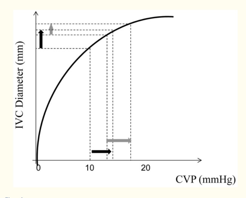 6/11# #IVC evaluation in a passive MV patient- In passive PPV (i.e. no patient efforts e.g. paralyzed):Inspiration --> ITP --> CVP --> IVC diameter (IVC distends)Again, the degree of IVC distension will depend on the CVP that would affect how full it is at baseline.
