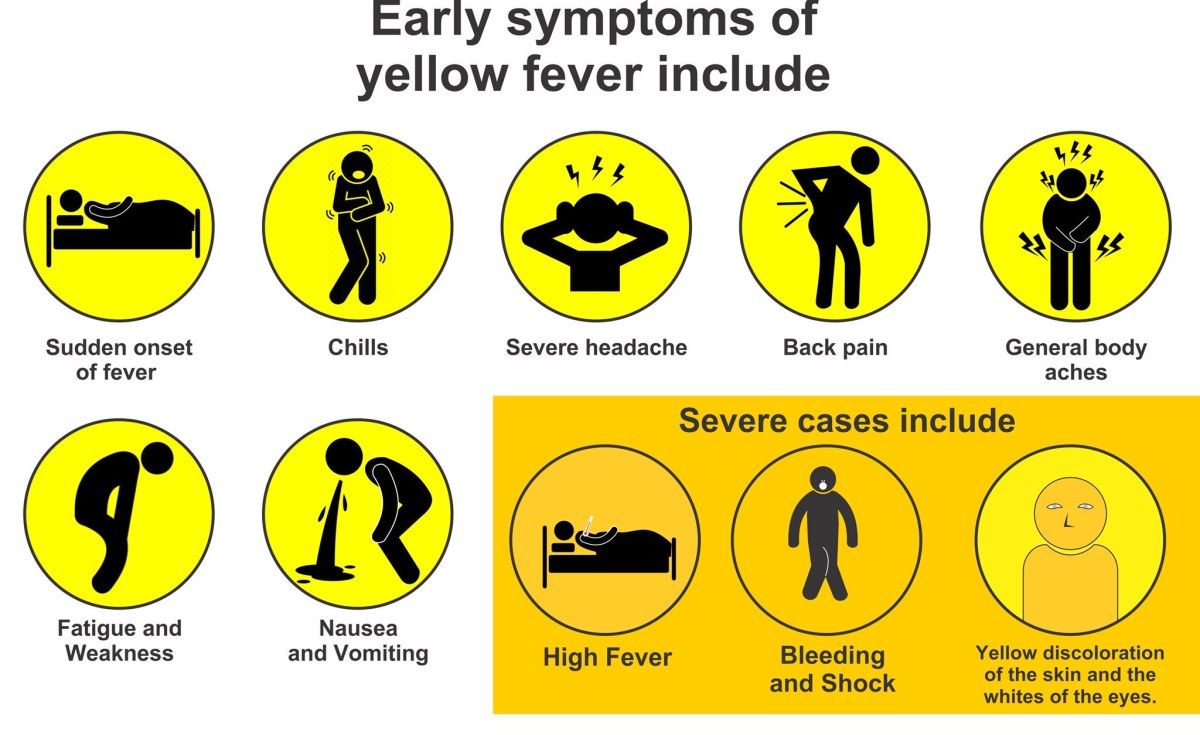 Yellow fever is a mosquito-borne virus native to tropical West Africa. Many get a mild case. But a minority become jaundiced and develop haemorrhagic fever—giving the disease one of its charming 150+ nicknames, vómito negro. 50% of C19th victims died, screaming in agony (2/n)