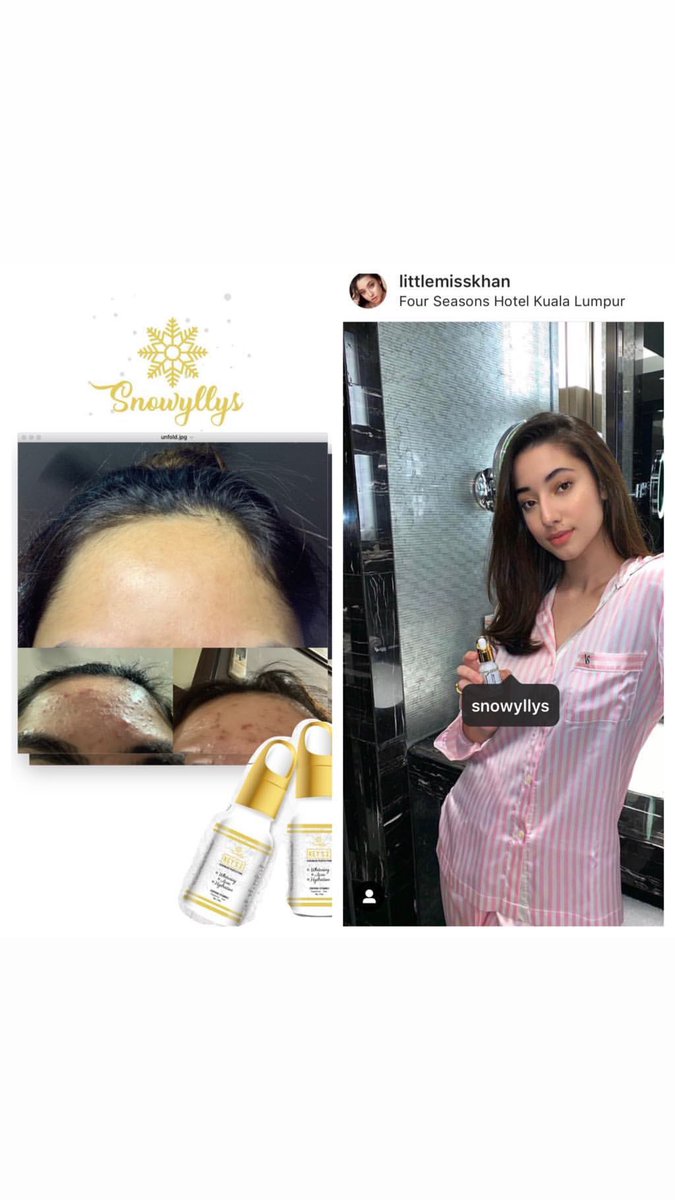 snowyllys's tweet photo. [RM40 FREE POSTAGE MCO SALES]

JOM BEBAS JERAWAT WITH SNOWYLLYS 

https://t.co/zwhhuk8nQZ https://t.co/v5ked9zRFB