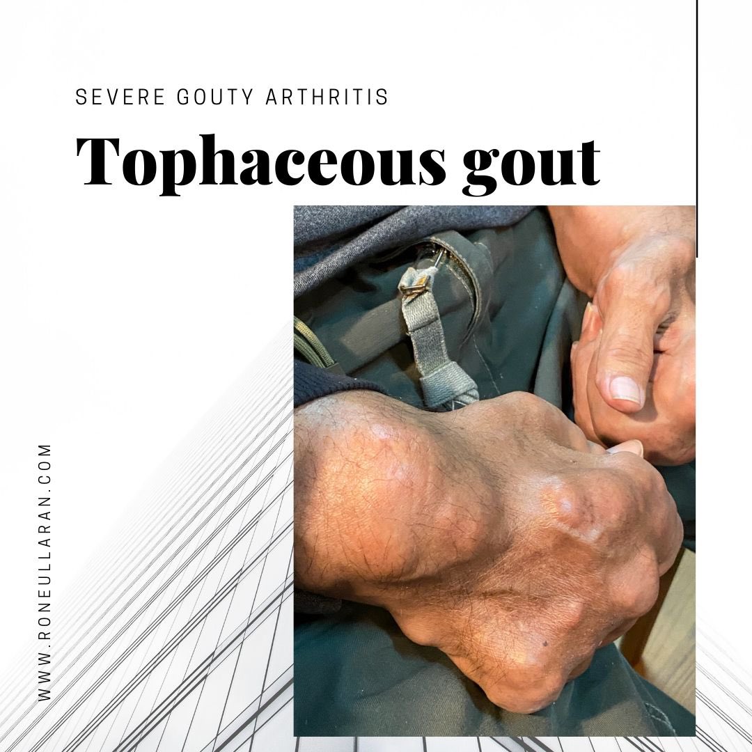 Ron Eullaran tweet media