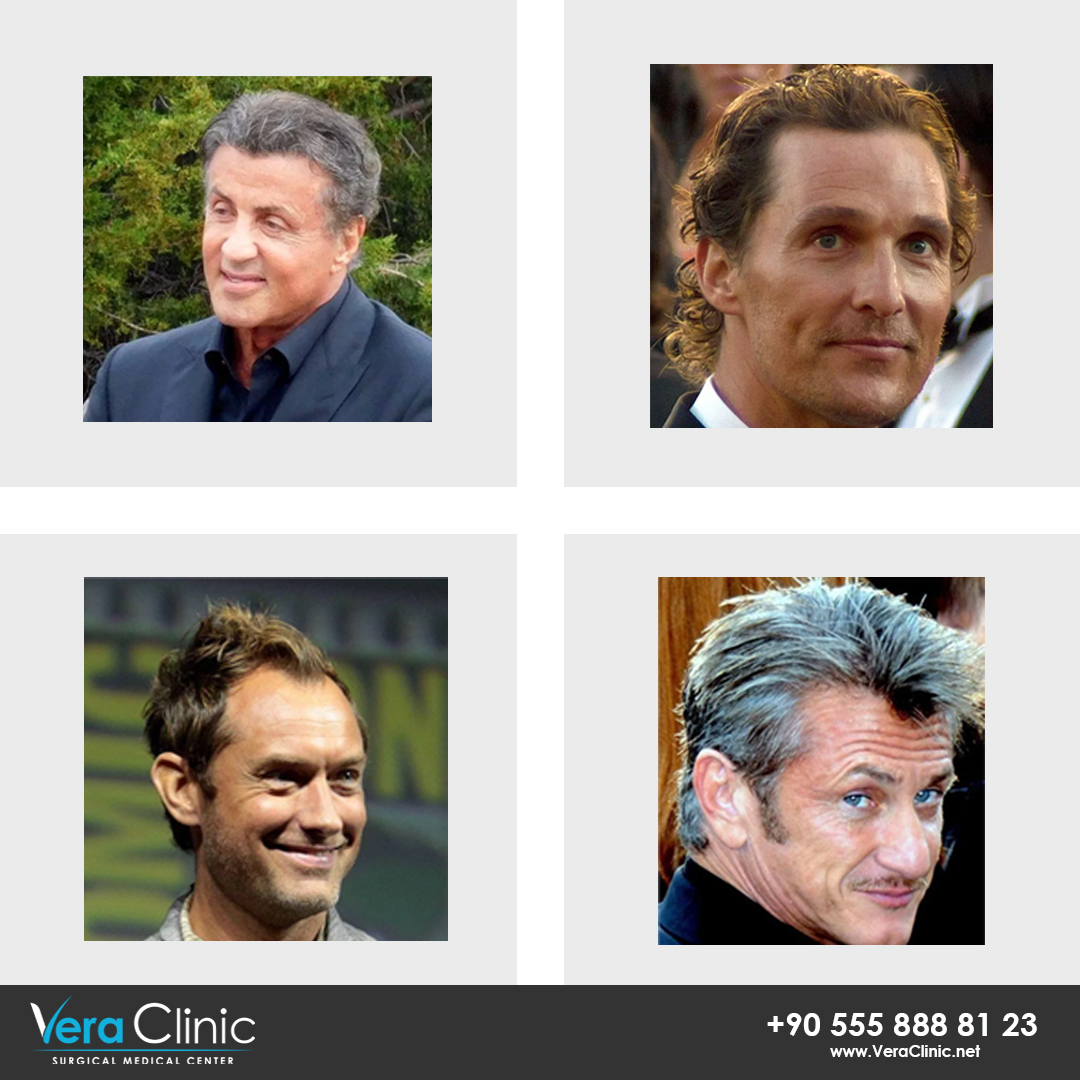 Vera Clinic on Twitter: "Here are top movie stars who had hair transplant  operation to maintain their natural hairline and charisma. Which is your  favorite? -Matthew McConaughey -Sean Penn -Jude Law -Sylvester