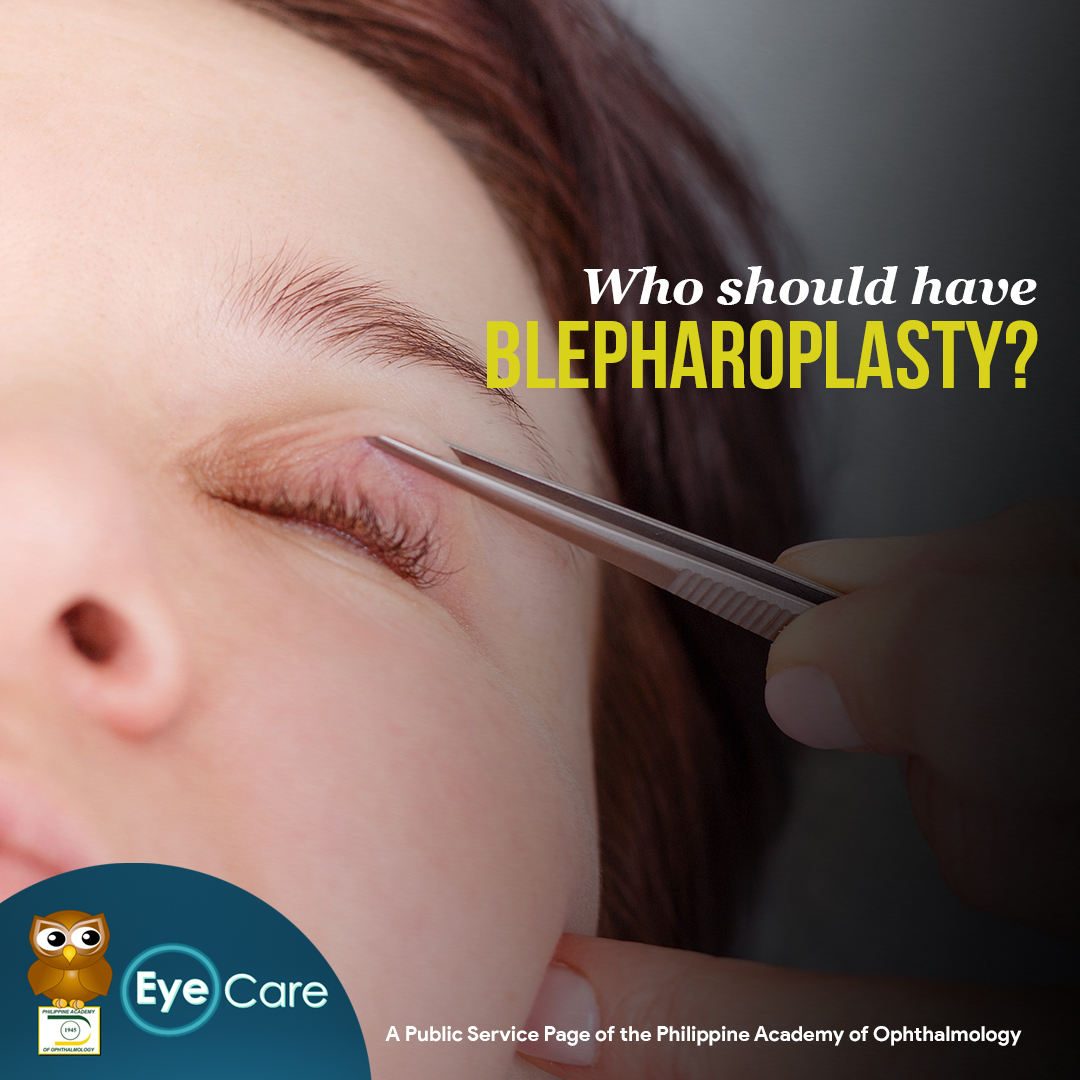 PAOEyeCare's tweet photo. You might consider #blepharoplasty if sagging eyelids prevent you from opening your eyes completely, or pull down your lower eyelids. Blepharoplasty can improve your vision and make your eyes appear younger and more alert. #EyeCare #youreyecareauthority #eyelidsurgery https://t.co/scwS9r6MqB