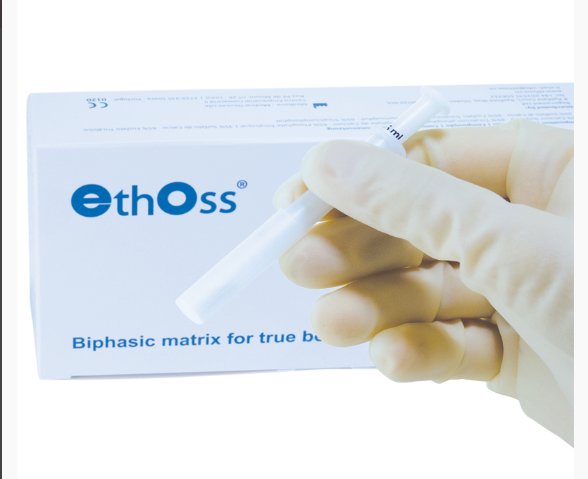 ApexInno's tweet photo. Ethoss Bone Graft! Proven to grow 50% new bone in just 12 weeks. Works with the body’s healing process by creating a calcium-rich environment and is completely absorbed.https://t.co/kcBBWShrGR
#dentalimplant #dentalcare #dental #dentistry #PDGI 
#bonegraft #boneregeneration https://t.co/dzlJQXQbeh