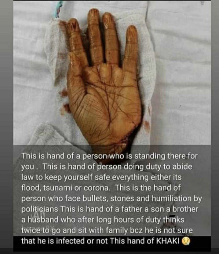 Ghastly act! Pls respect Police jawans for risking their lives to keep u safe ! #protectthefrontline #Coronafighters #PunjabPolice #Indianpolice #IndiafightsCovid19