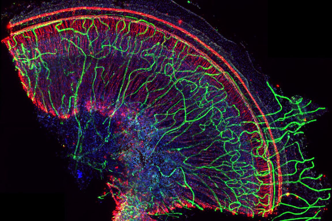 NECordBlood's tweet photo. Check out these amazing images from the 2019 UCLA microscopy and video contest! 
https://t.co/UzIVQHqcyD https://t.co/h6OXoxyLGM
