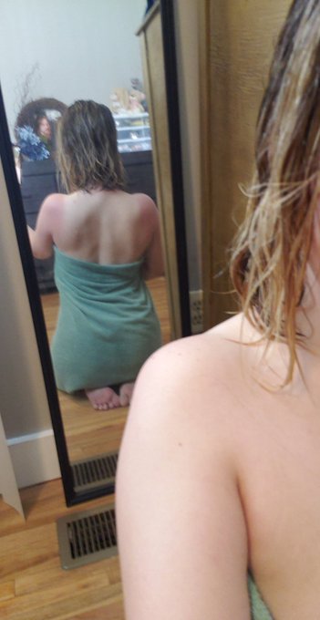 Note to self, always wear sunscreen while doing yard work.... 🦞 #sunburnt https://t.co/l5kBc329LA<a href="/tag/sunburnt"class="tags"><span>#sunburnt</span></a>