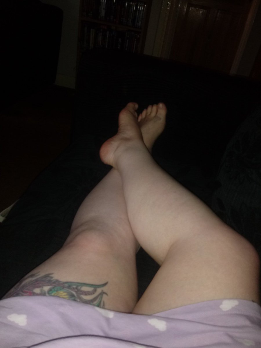 BlackandBlue73's tweet photo. My night. #fatthighs #bruisedtoe #needmoreink https://t.co/BkBVmHaUF5