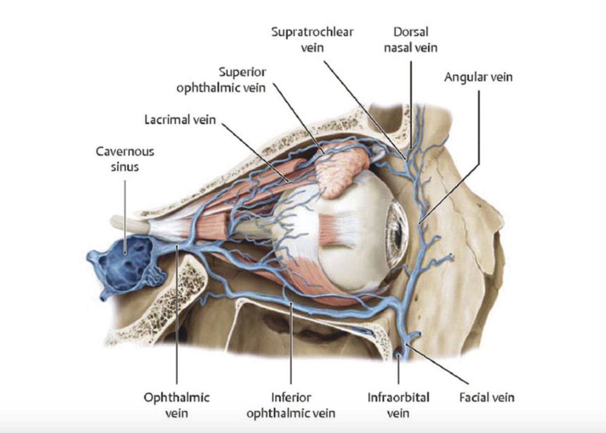 7/ ?Does direct invasion of  #SARSCoV2 through the nasal or eye mucosa/nerves increase risk for intracranial invasion —> neurological findings? ?Have we seen other eye findings like Adie’s pupil (viral inflammation/destruction of cilliary ganglion)? Or trigeminal neuralgia?