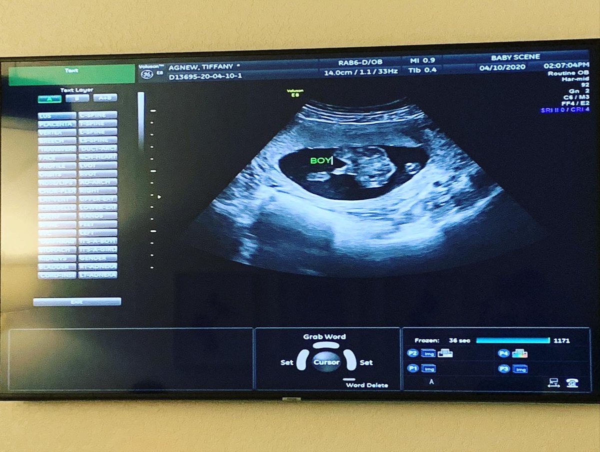 BabyScene1's tweet photo. #teamboy or #teamgirl

#parentstobe
#babyboy
#babygirl
#ourbaby
#baby
#pregnancylife
#3d4dultrasound
#babybump
#4dultrasound
#momtobe
#babyultrasound
#genderrevealparty
#babyscan
#hdliveultrasound
#genderreveal
#genderrevealultrasoundtampa
#babyscene
#babyscene1
#seetheawe https://t.co/nW5vn8zw6X