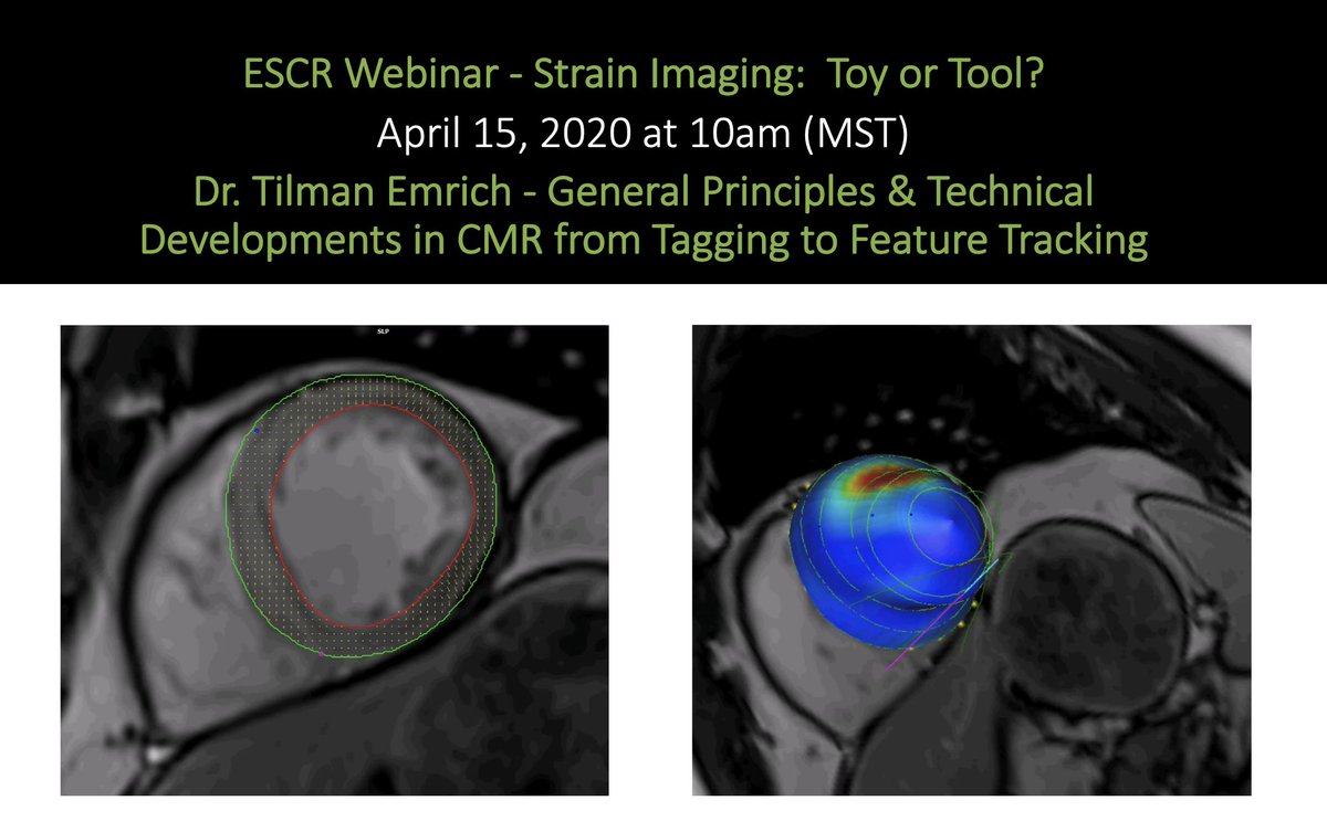 Don't miss Dr. <a href="/TilmanEmrich/">Tilman Emrich</a>  on "The Principle and Understanding of Strain Imaging" in the #ESCR Webinar on April 15 at 10am (MST)! Register here: @ESCR register.gotowebinar.com/register/17857…  #WhyCMR #CMR #CardiacImaging