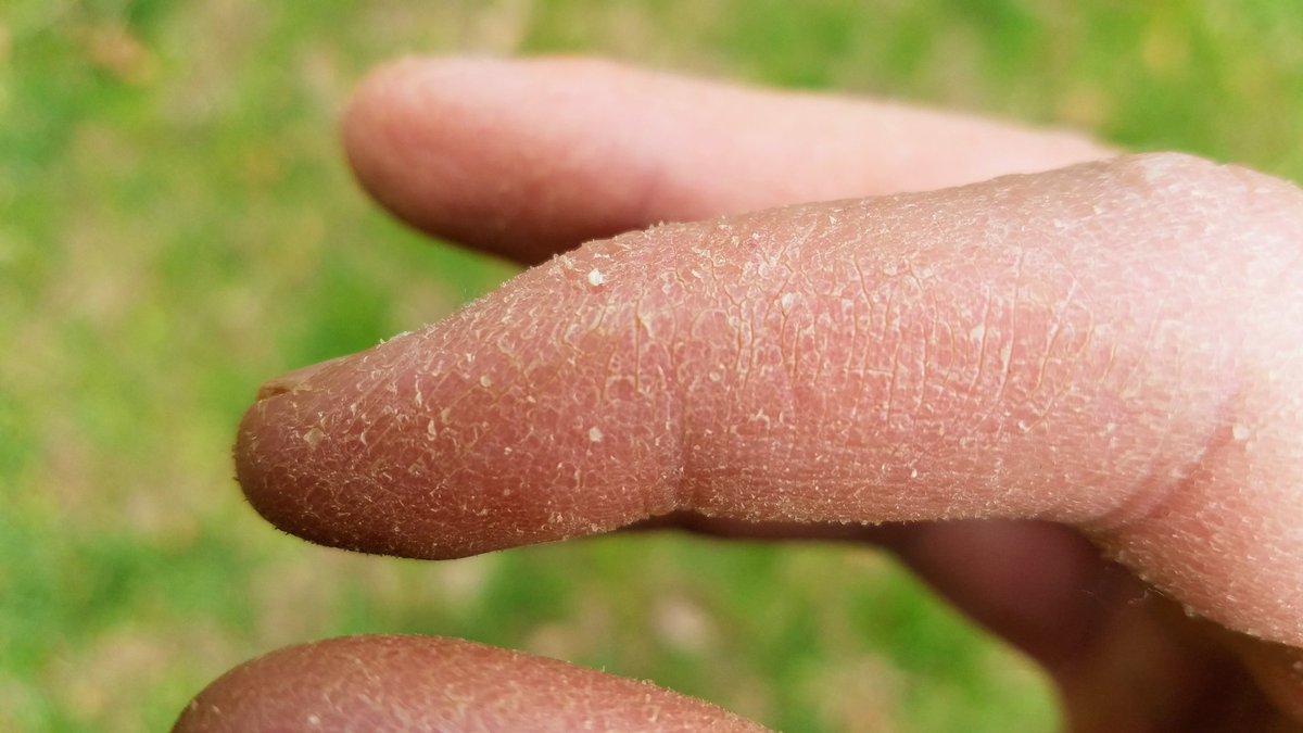 RyanAKoons's tweet photo. My skin has become SO scaly from the time spent in the garden that I've begun to wonder if one of my English ancestors had a dalliance with a dragon... https://t.co/ZFzAaQispm