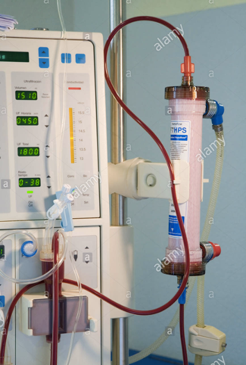 5/ Strategies to maximize clearance (particularly relevant now given the  #COVID19-related strain on KRT):Bigger filter sizeHigher dialysis blood flow rates (usually, these are 300-400 cc/min)Widen the concentration gradient and try a potassium-free dialysate