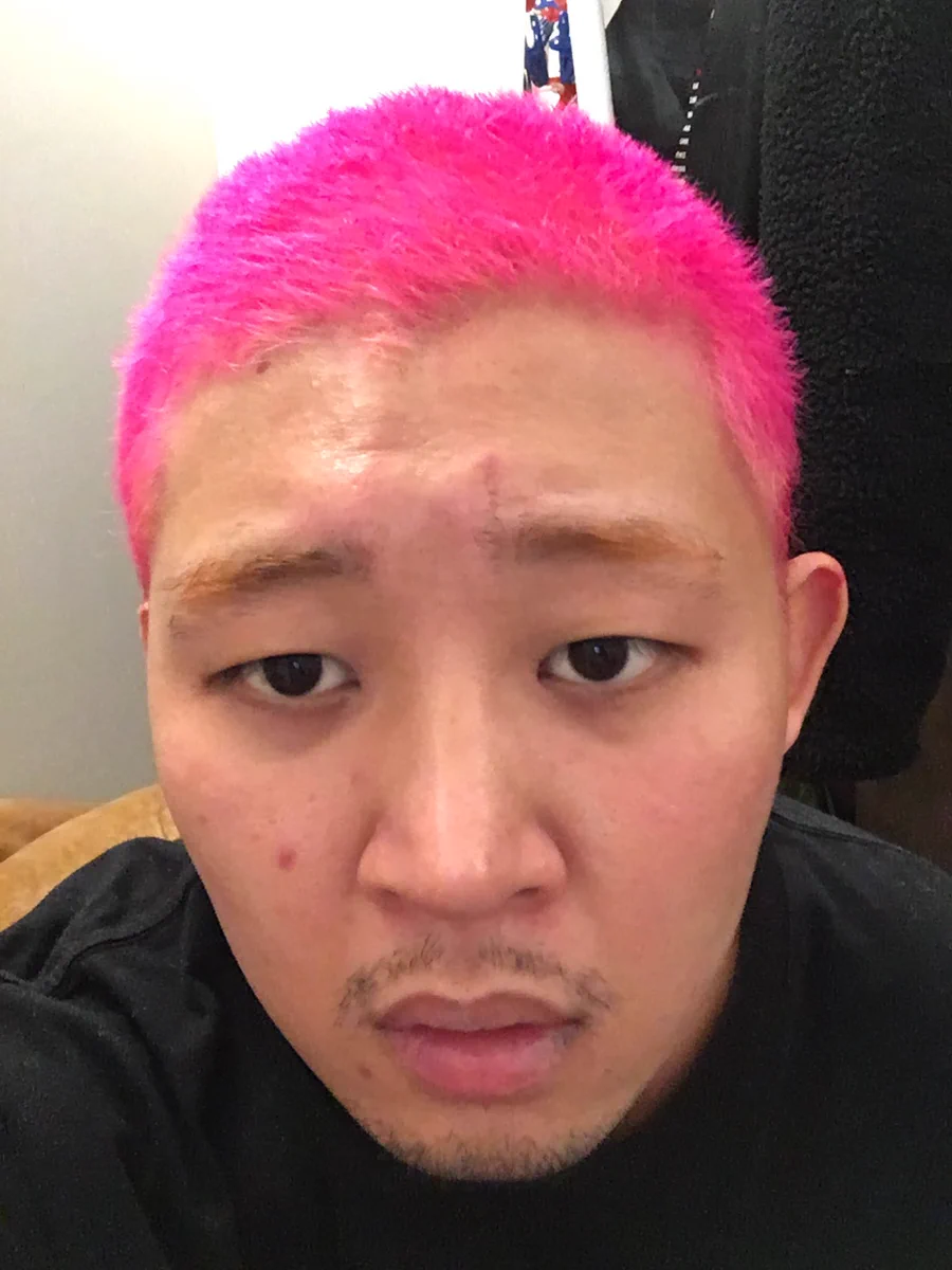 四千頭身の後藤がセカオワのFukaseに憧れて髪をピンクに染めた結果ｗｗｗ衝撃的過ぎてワロタｗｗｗｗｗ