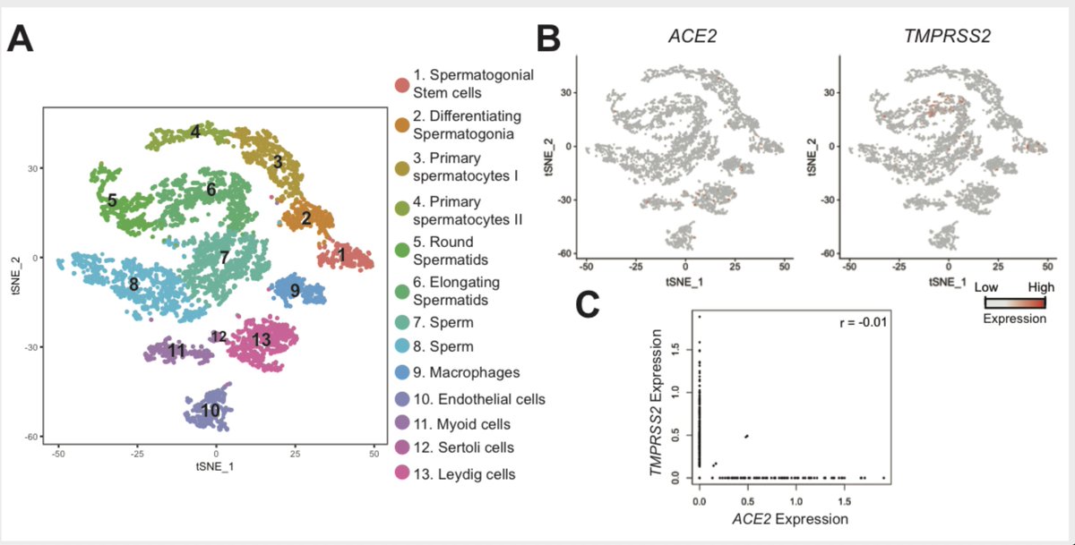 Jim Hotaling, M.D. (@jimhotalingmd) on Twitter photo No evidence of SARS-CoV-2 in semen of men recovering from COVID-19. Receptors on testis cells do not appear to be sufficient for virus to get in. Nice work by Wuhan team/Cornell/Columbia <a href="/UtahMensHealth/">UtahMensHealth</a> @ReprodMed <a href="/SSMR_malefactor/">Society for the Study of Male Reproduction</a> @ReprodMed_SMRU
…s-jbs-prod-cdn.jbs.elsevierhealth.com/pb/assets/raw/… No evidence of SARS-CoV-2 in semen of men recovering from COVID-19. Receptors on testis cells do not appear to be sufficient for virus to get in. Nice work by Wuhan team/Cornell/Columbia <a href="/UtahMensHealth/">UtahMensHealth</a> @ReprodMed <a href="/SSMR_malefactor/">Society for the Study of Male Reproduction</a> @ReprodMed_SMRU
…s-jbs-prod-cdn.jbs.elsevierhealth.com/pb/assets/raw/…