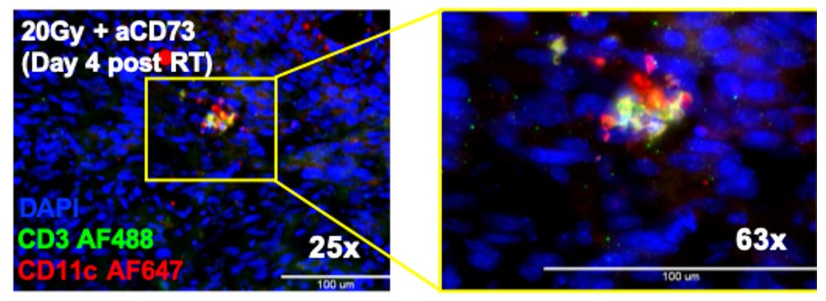 Cancer Immunology Research (@cir_aacr) on Twitter photo Want to know what therapy combinations could be used to enhance the efficacy of #radiotherapy? Find out here: bit.ly/2REqRmT @MeyerCancer @WCMRadOnc <a href="/WeillCornell/">Weill Cornell Medicine</a> @erik_wennerberg <a href="/NP_Rudqvist/">Nils-Petter Rudqvist</a> <a href="/SheilaSpada/">Sheila Spada</a> #CD #adenosine #ImmuneCheckpointBlockade #DCs #AbscopalEffects Want to know what therapy combinations could be used to enhance the efficacy of #radiotherapy? Find out here: bit.ly/2REqRmT @MeyerCancer @WCMRadOnc <a href="/WeillCornell/">Weill Cornell Medicine</a> @erik_wennerberg <a href="/NP_Rudqvist/">Nils-Petter Rudqvist</a> <a href="/SheilaSpada/">Sheila Spada</a> #CD #adenosine #ImmuneCheckpointBlockade #DCs #AbscopalEffects