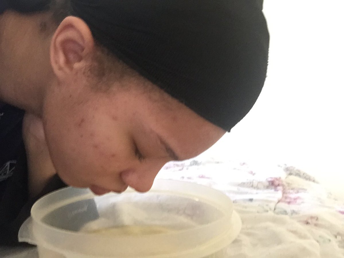 IvyCorreia98's tweet photo. Another one of my moms ideas. Steaming my face with hot water, lemon and eucalyptus #livetweeting #LifeInALockdown #COVID19 #liusms https://t.co/rY8dX2PxZu