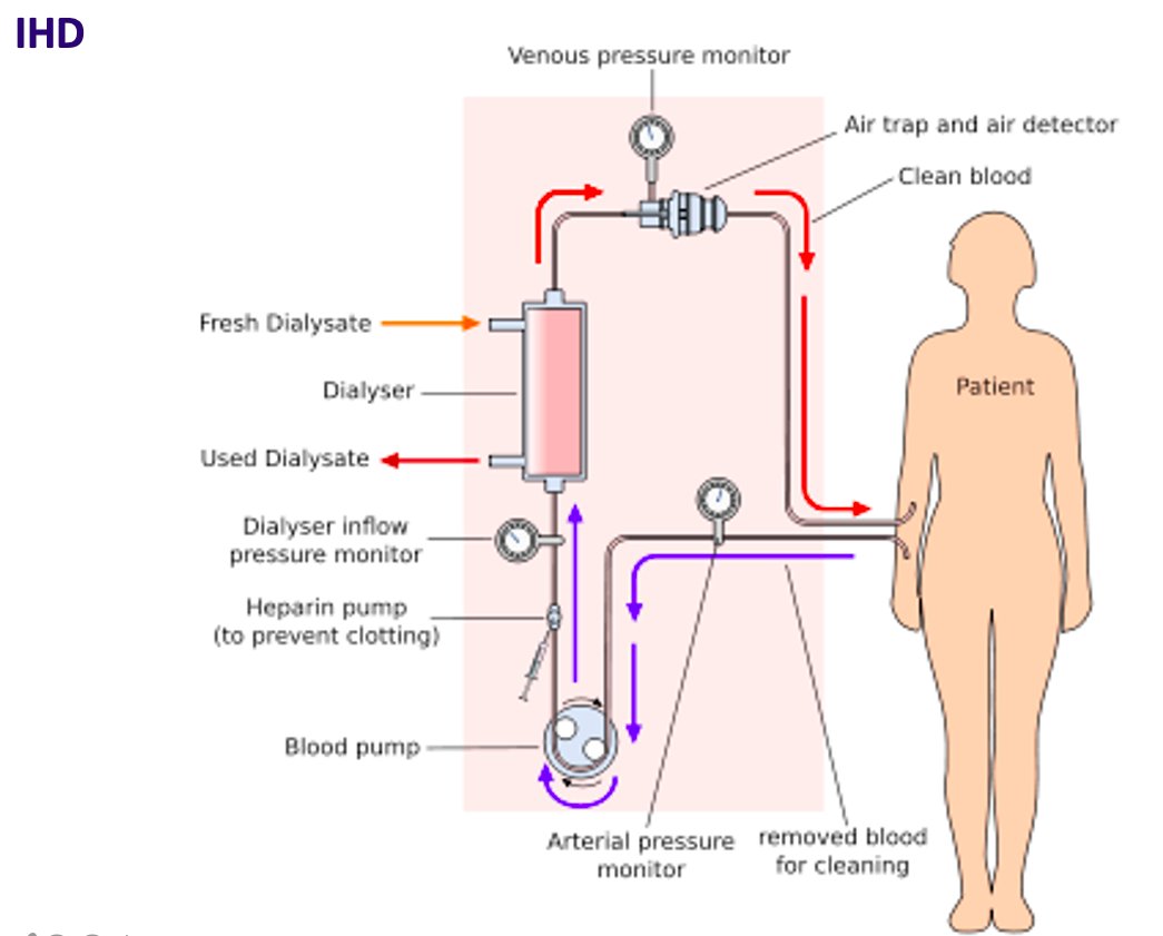 7/ Here's what goes into the iHD order:Access, blood flow, + dialysate flow rates (standard 800 cc/min)Dialysate compositionUltrafiltration volumeFilter sizeDuration (standard 3.5hrs - though  #COVID19 has forced shorter treatment times, affecting clearance)