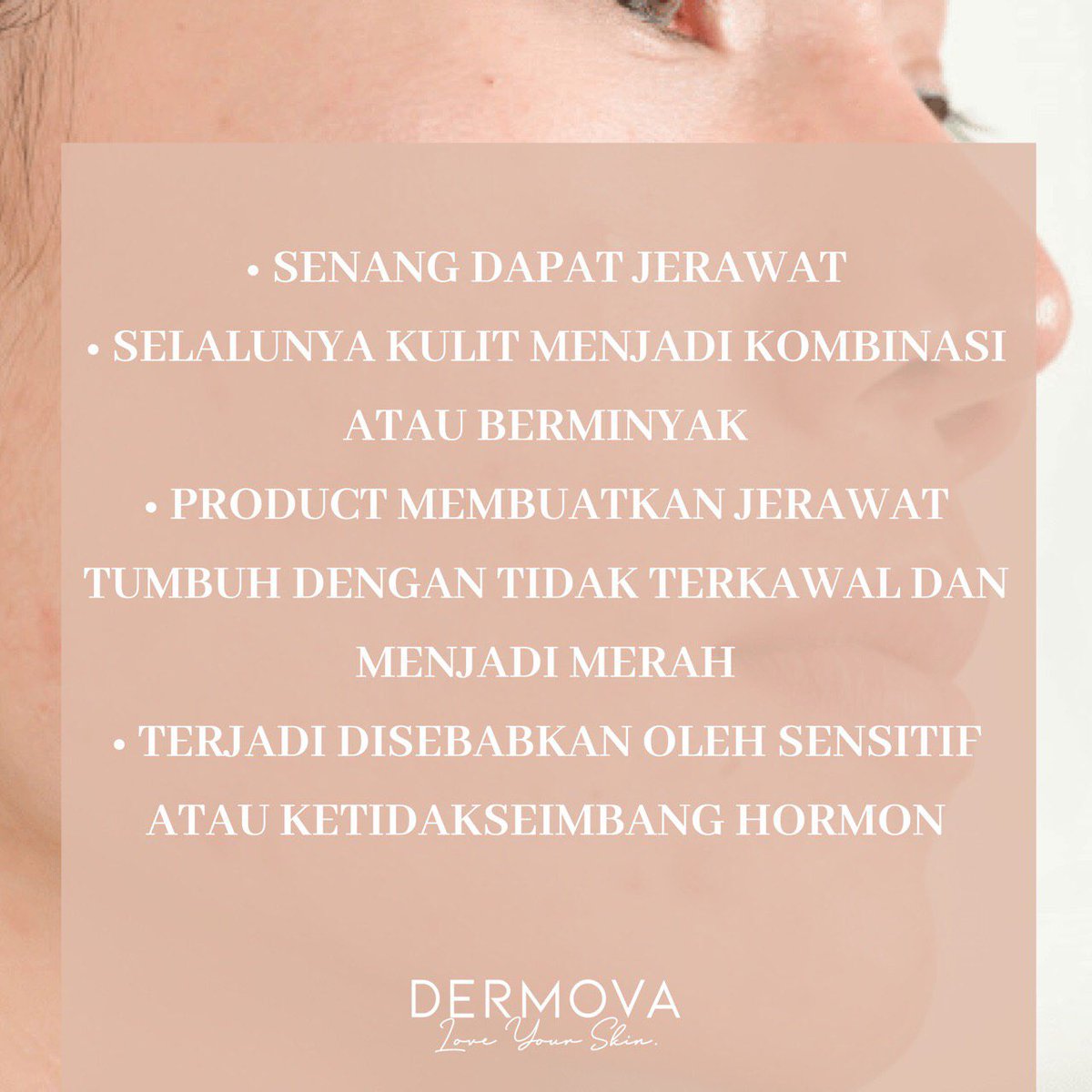 Apa Itu Acne Prone - simoda kimici