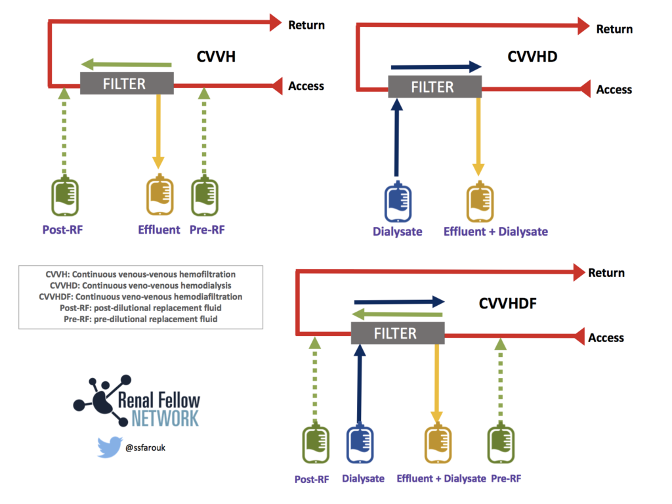 12/ The graphic below illustrates the differences between  #CVVH,  #CVVHD, and  #CVVHDFCVVH: Convection + replacement fluid; dialysateCVVHDDialysate + convection;  replacement fluid CVVHDF: Dialysate + convection + replacement fluid  @RenalFellowNtwk  #FOAMed