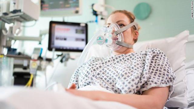 There are less-invasive alternatives, including oxygen tubes (or cannulas) and machines that push air into your lungs, like one called the BiPAP. With many respiratory illnesses, doctors will try these less invasive options first and intubate later, if necessary. (3/15)