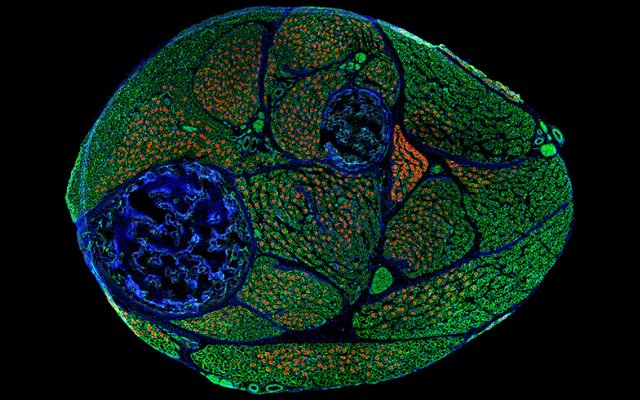 India_Alliance's tweet photo. What's that stunning #image?

Zoomed-in view of #muscles in the leg of a #LaboratoryMouse 🐭🔬

India Alliance fellow Sam Mathew &amp; team @unescorcb show the role of a #gene MYH3 in muscle development &amp; #disease, in @Dev_journal👏🏽

#ResearchHighlight ▶ https://t.co/XivB7x5KJJ https://t.co/uk9E1NRNcW
