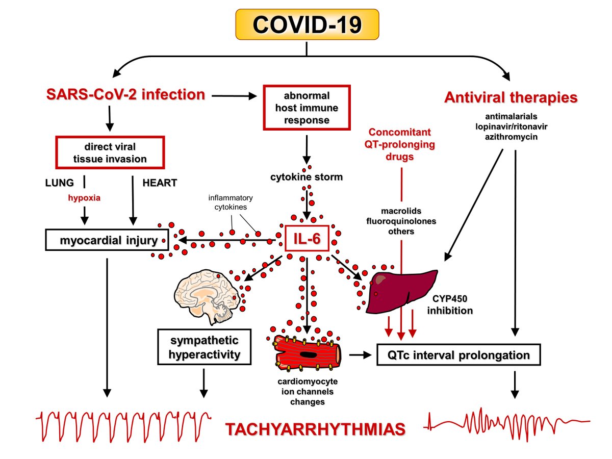 Just Published Online: #OnMyMind: #COVID19, Arrhythmias and Inflammation #AHACOVID19 #AHAJournals <a href="/AHAScience/">AHA Science</a> ow.ly/zYB250zdZbX