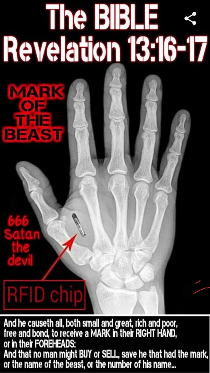 ThugAngel11's tweet image. #How2020CouldGetWorse
The evil agenda on pushing us all into the 🌍 #cashlesssociety #microchipimplants