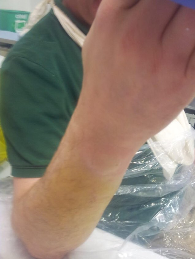 Can anyone beat or get close to 4 all out? Thanks Dave 🤣