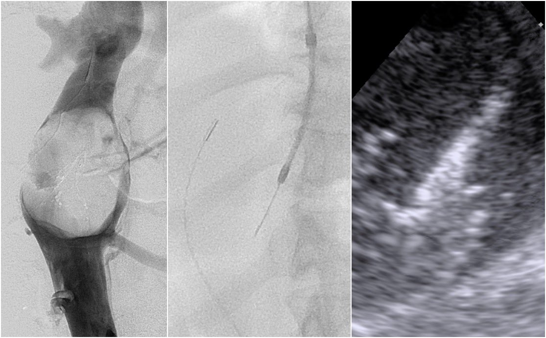 Jeffrey F. B. Chick, MD, MPH tweet media