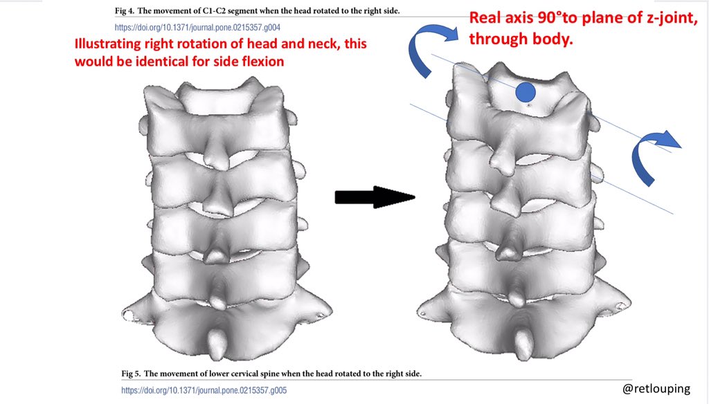 Functional left rotation. This may take a bit of time to absorb and work with to get the implications and use of head v neck joint motion. Remember side bending & rotation are the same for the neck joints biomechanically hence the restriction is in the neck jointsAs seen below