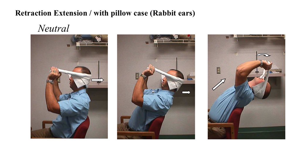 The treatment self movement for this issue is actually to utilize sagittal neck motion, that was described yesterday. The neck responds best by doing sagittal motion even when restrictions are unilateral. So Rabbit ears, retraction and or retraction extension are the choice.