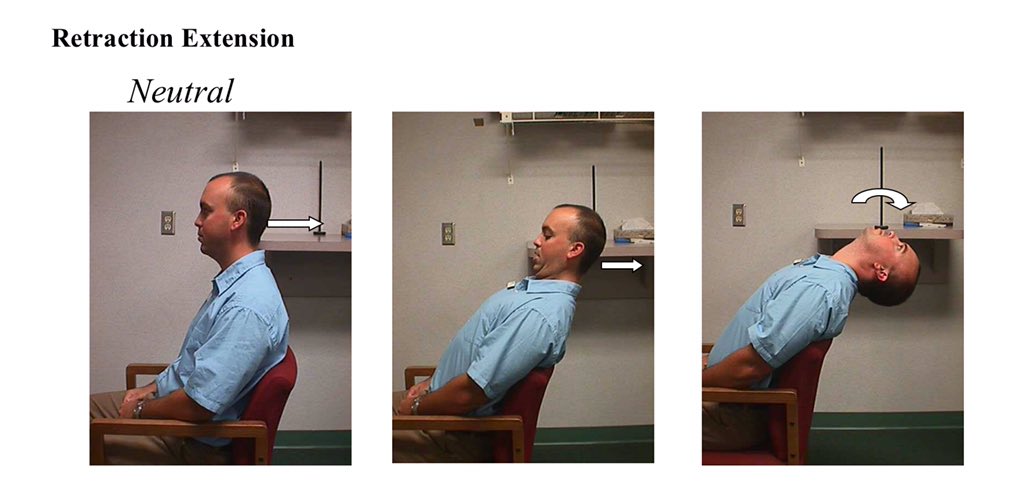 The treatment self movement for this issue is actually to utilize sagittal neck motion, that was described yesterday. The neck responds best by doing sagittal motion even when restrictions are unilateral. So Rabbit ears, retraction and or retraction extension are the choice.