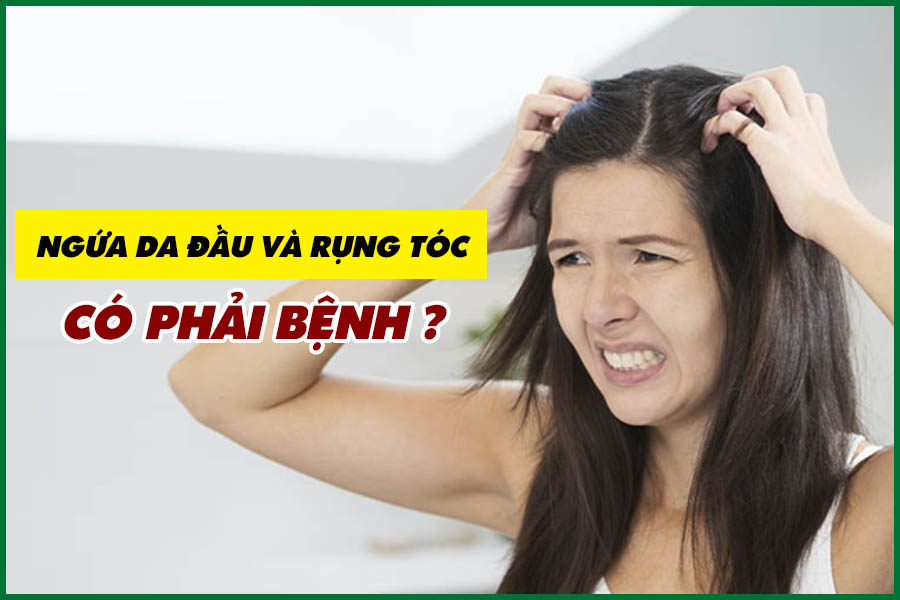 jakata1982's tweet photo. Ngứa da đầu và rụng tóc khiến bạn cảm thấy phiền toái, khó chịu, đôi khi còn làm bạn mất tự tin khi đối diện với những người bên cạnh. https://t.co/7B1YnafEav https://t.co/EiAeSYRAaH
